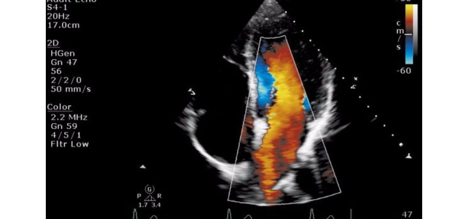 Philips ClearVue 550