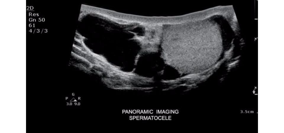 Philips ClearVue 550