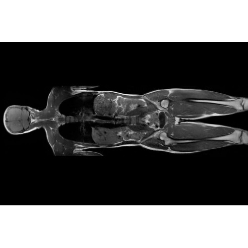 МРТ аппарат GE SIGNA Creator 1.5T